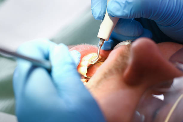 Best Broken or Chipped Tooth Repair in Yarmouth Port, MA